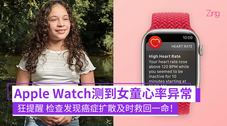 Apple Watch CP